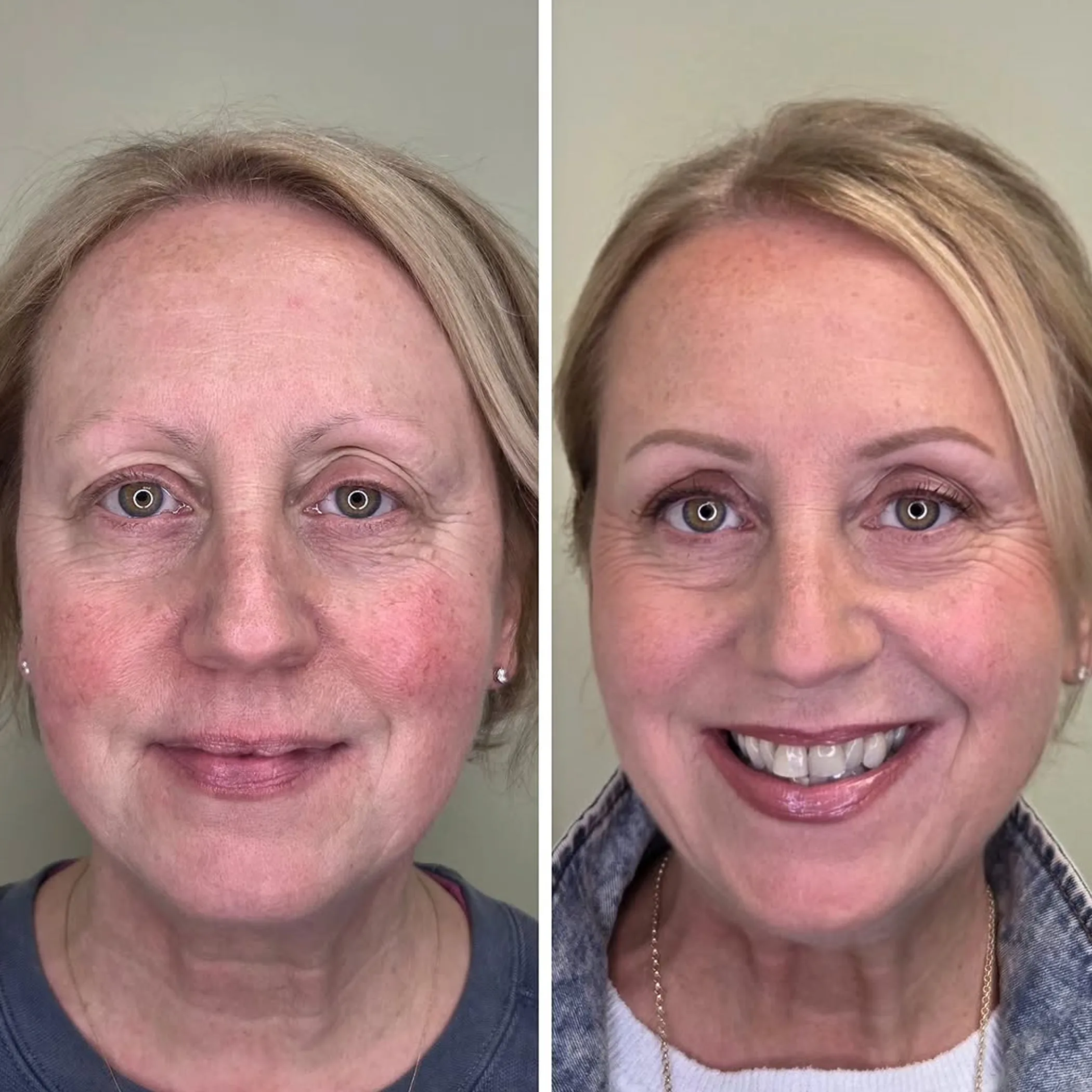 permanent eyebrow procedure
